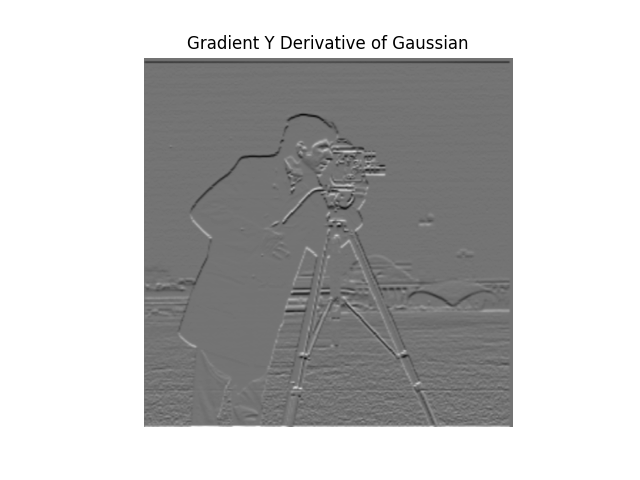 Gradient Y (DoG)